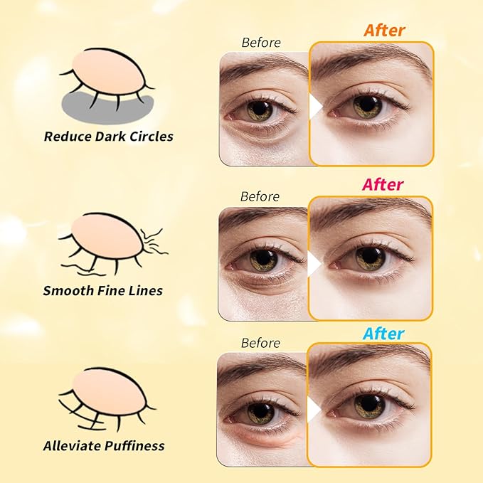 Under Eye Patches(24 Pairs), 24K Gold, Caffeine, Retinol Eye Masks for Puffy Eyes, Wrinkles, Dark Circles, Undereye Bags Treatment - Restoring & Awakening & Moisturizer Skin care Gift for Women