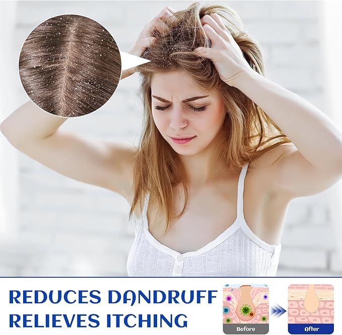 HIQILI Rosemary Oil for Hair Growth, Skin, Scalp, 100% Pure Natural, Add to Shampoo & Conditioner - 0.33 Fl Oz/10 ML