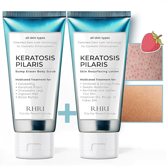 KP Bump Eraser Body Set | Keratosis Pilaris Treatment | Keratosis Pilaris Lotion | Exfoliating Body Scrub | Ingrown Hair Treatment | Bundle Set for Bump, Strawberry Legs, Redness, Dry & Flakey Skin