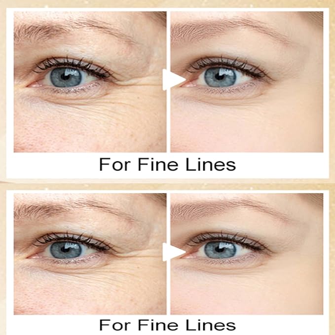 20g Eye Cream with Electric Massager, Moisturizing Anti-Wrinkles Eye Cream, Anti Aging Eye Cream for Dark Circles and Puffiness, Results in 3-4 Weeks to Reduce Fine Lines