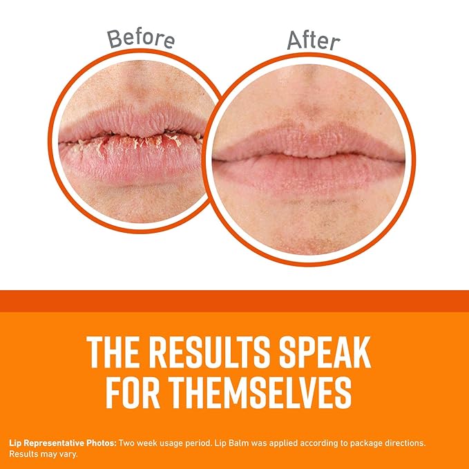 O'Keeffe's Unscented Lip Repair Lip Balm for Dry, Cracked Lips, Stick, (Pack of 12)