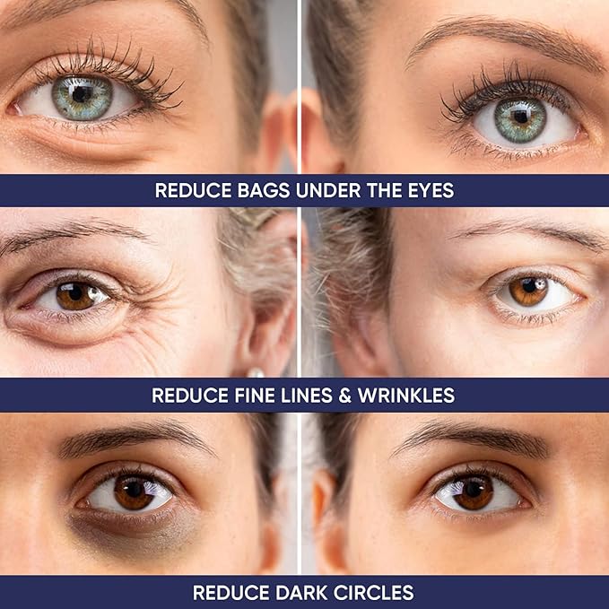 Instant Ageless Eye Cream – Anti Wrinkle Cream, Removes Under Eye Puffiness, Bags, Expression Lines, & Dark Circles. Powerfully Tighen & Lifts Sagging Skin. Disappears Before Your Eyes In Minutes.