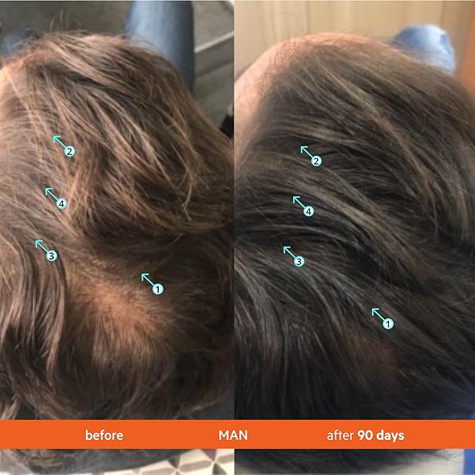 DS Labs Revita Shampoo – High-Performance Hair Density Shampoo, Volumizing & Thickening, Fuller, Healthier-Looking Hair, Sulfate & Silicone Free, For Men & Women, 205mL