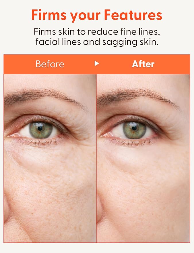 It'S SKIN Collagen Nutrition Eye Cream - Eye Bag Cream Eye Care w/Collagen | Korean Eye Cream for Dark Circles and Puffiness | Beauty & Personal Care Under Eye Cream for Puffiness and Bags 0.88 oz