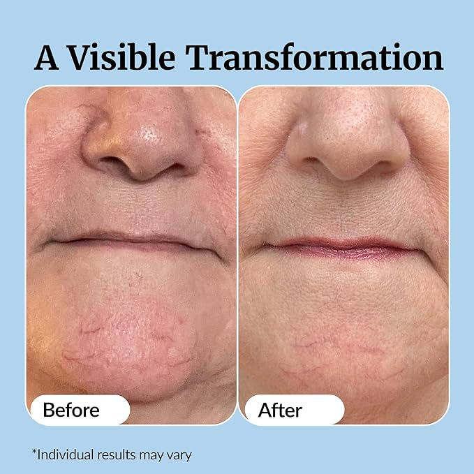 Vibriance Super C Serum for Mature Skin - All-in-One Vitamin Formula Hydrates, Firms, Lifts, Smooths, Targets Age Spots, Wrinkles, 1 fl oz - Pack of 3