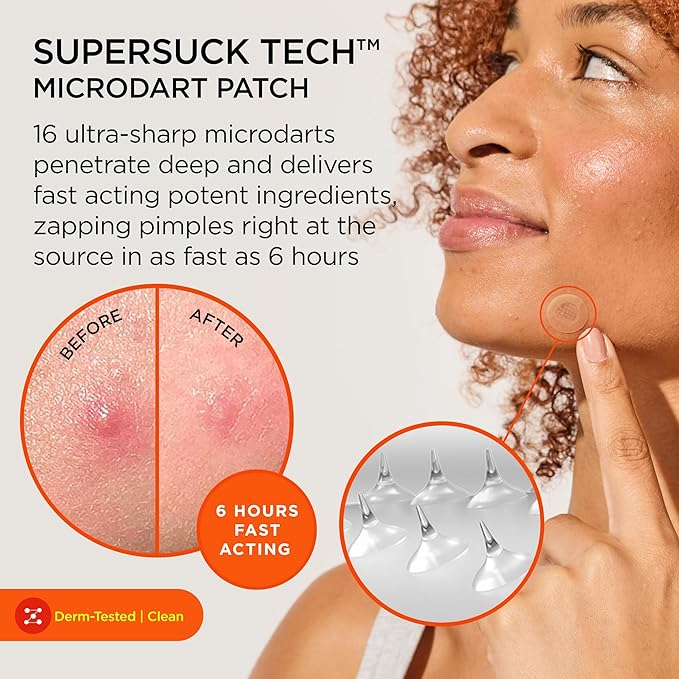 ZitSticka Killa Mini Acne Patches for Face - World's Most Potent Pimple Patch with Fast-Acting Microdarts - Starts Working within 2 Hours for Deep, Early-Stage Zits - 8 Count