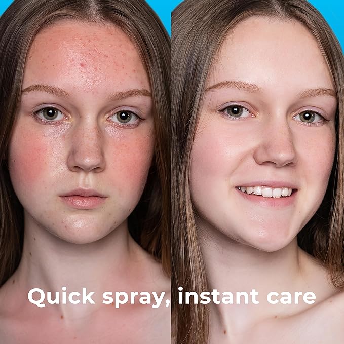 Hypochlorous Acid Spray (8oz, 2 packs), HOCL Facial Cleanser Acne Spray for Face, Body, Eczema, Pimples, Breakouts & Overall Skin Recovery (Reduces Redness)