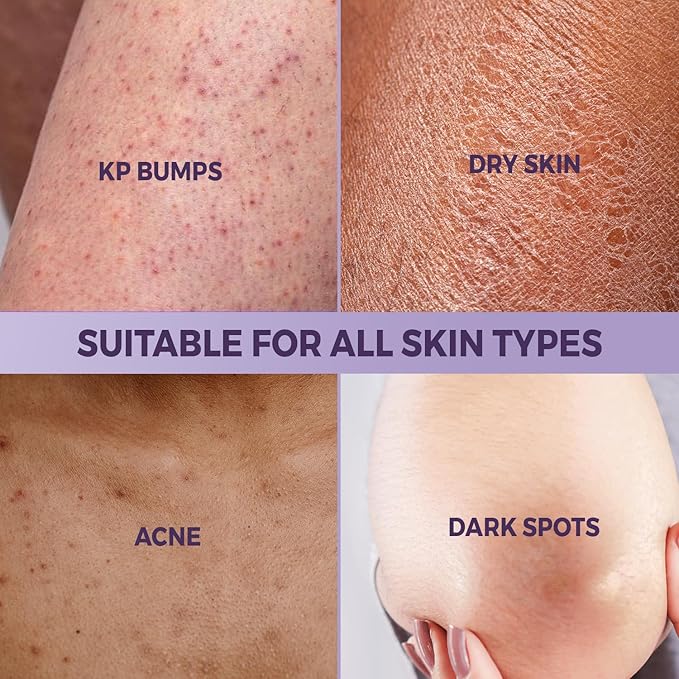 KP Exfoliating Body Treatment with 10% AHA – Non-Gritty Cream Formula with Glycolic & Lactic Acids for Smoother-Looking Skin, Made in USA – 4 oz