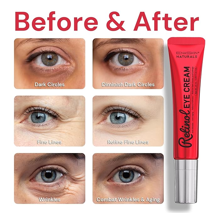Retinol Under Eye Cream for Dark Circles & Puffiness, Daily Wrinkle Cream, Anti Aging Line Smoothing Skin Care Treatment for Women and Men, 1.7 fl. oz