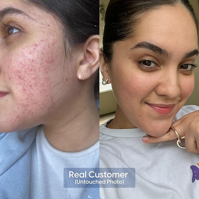 Strive - Anti-aging Retinal Serum - 0.1% Retinaldehyde, 10% Peptides & 2% Vitamin C E Ferulic Face Serum. Brightening, Firming, Wrinkle & Fine Line Reducing - Fragrance Free Anti aging Skincare - 30mL