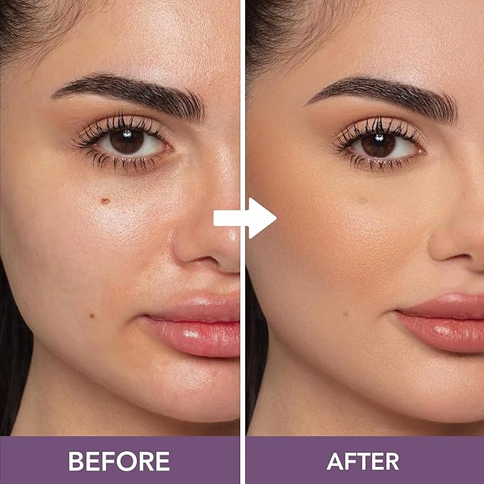 Dermaflage Full Coverage Concealer Cream, Tan, 11 Versatile Shades, Waterproof, Non-Greasy, Matte Finish, Conceals Acne, Dark Circles, Blemish Spots, Tattoos, Bruises, Scars