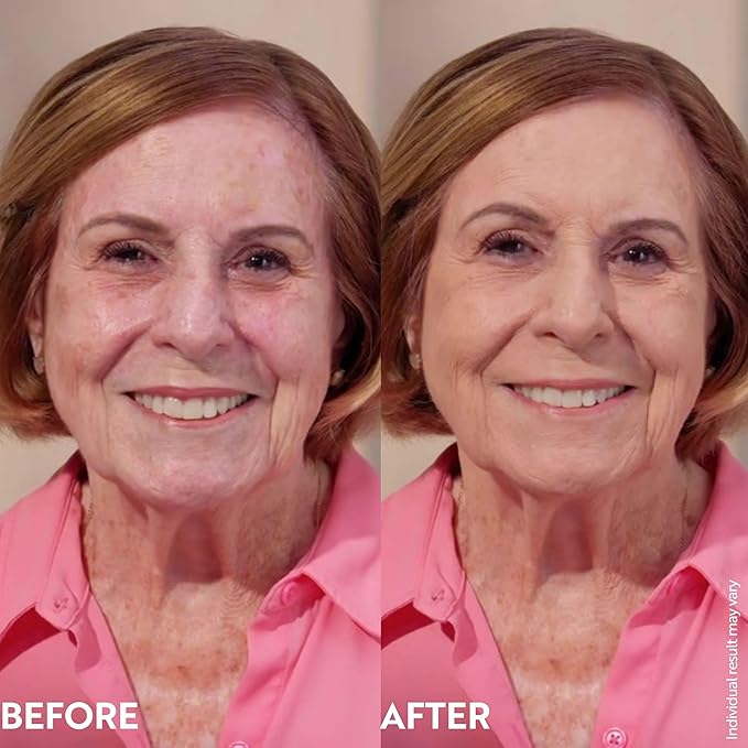 M. Asam Magic Finish Make-Up Mousse (1.01 Fl Oz) – 4in1 Primer, Foundation, Concealer & Powder With Buildable Coverage, Hides Redness And Dark Spots, Vegan, For Light To Medium Skin Tones