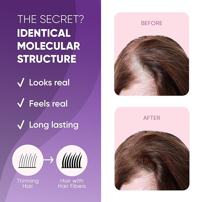 GBG Hair Fibers for Thinning Hair & Bald Spots (Dark Blonde) - 25g Bottle - Conceals Hair Loss - Instant Cover Up & Volume in 30 Seconds, Hair Powder for Women & Men - Cruelty Free