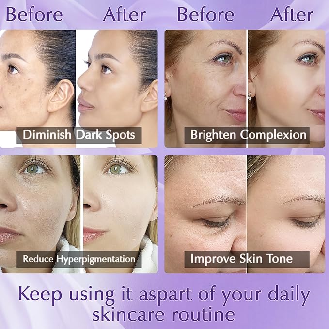 Dark Spot Remover for Face Cream, Dark Spot Corrector, Rapid Tone Repair Retinol Serum for Sun Spots, Age Spots, Skin Brown, Melasma Skin Care with Upgraded Formula Vitamin C for Women 1.7 Fl OZ