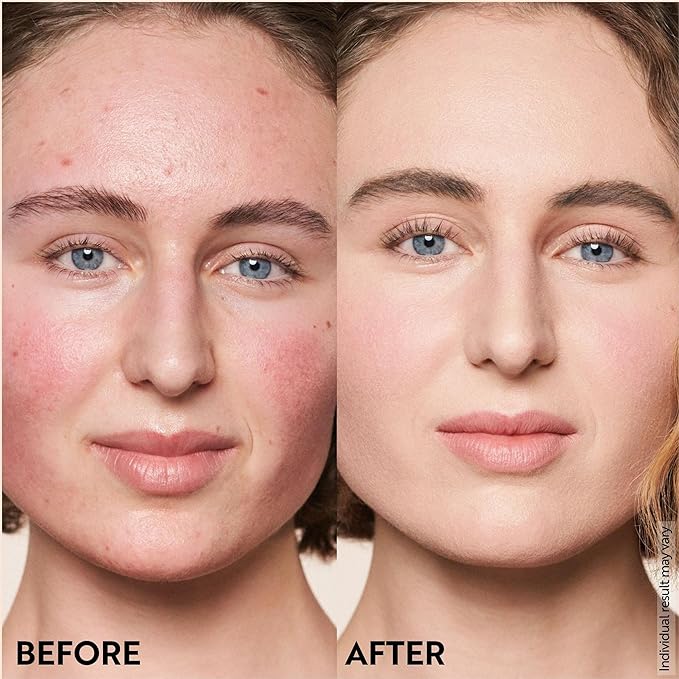 M. Asam Magic Finish Porcelain Teint Make-Up Mousse (1.01 Fl Oz) – 4in1 Primer, Foundation, Concealer & Powder With Buildable Coverage, Adapts To Fair Skin Tones, Leaves Skin Looking Flawless