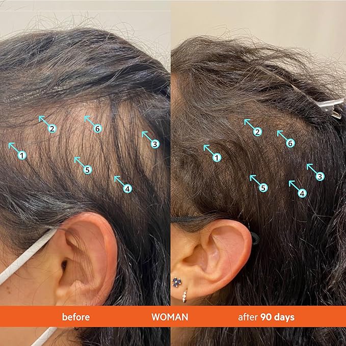 DS Labs Revita Shampoo – High-Performance Hair Density Shampoo, Volumizing & Thickening, Fuller, Healthier-Looking Hair, Sulfate & Silicone Free, For Men & Women, 205mL (Pack of 2)