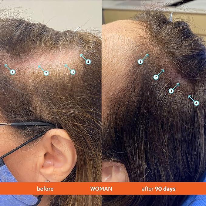 DS Labs Revita Shampoo and Conditioner – High-Performance Hair Density Kit, Volumizing, Thickening, Fuller, Sulfate & Silicone Free, For Men & Women, 925mL, Packaging May Vary