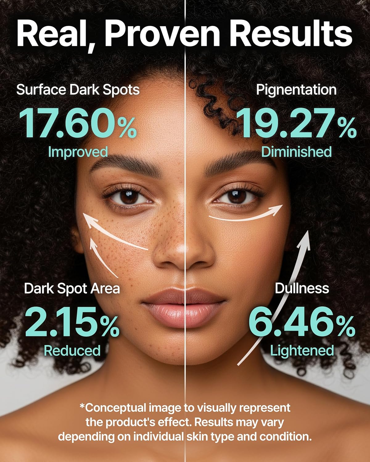 Charde Niacinamide 25% Snow Ampoule for Face, Dark Spot Care for Hyperpigmentation, Freckles & Sun Spots | Radiance Boosting with White Garcinia & Arbutin, Korean Skin Care, 1.01 fl. oz.